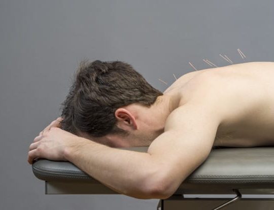 درای نیدلینگ (سوزن خشک)