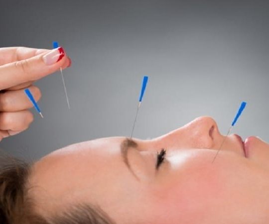 درای نیدلینگ (سوزن خشک)